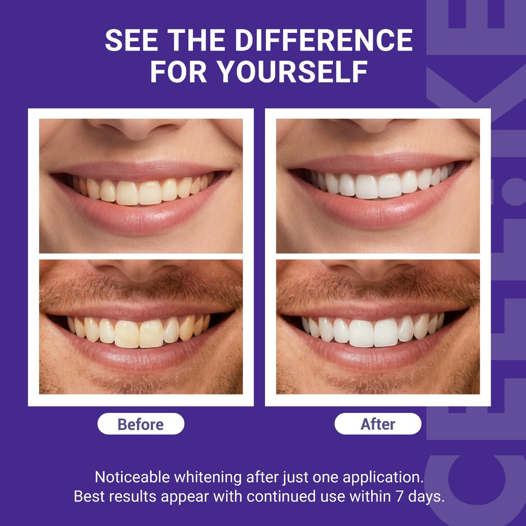 Purple Strips with PAP & nHAP - 14 Strips, 7-Day Use