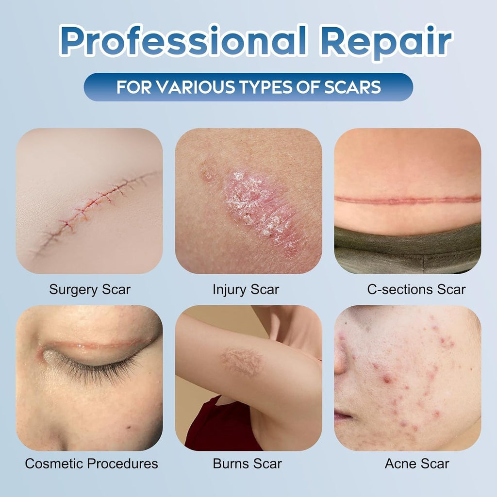 Scar Removal Gel for Surgical & Acne Scars - Silicone, Hydrating Formula