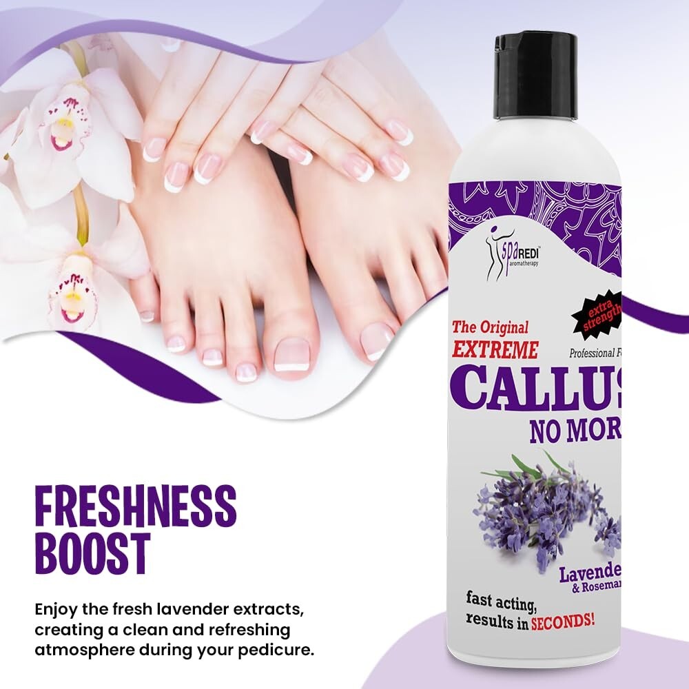 Callus Remover Foot Care Lotion with Lavender & Rosemary - 12 Oz