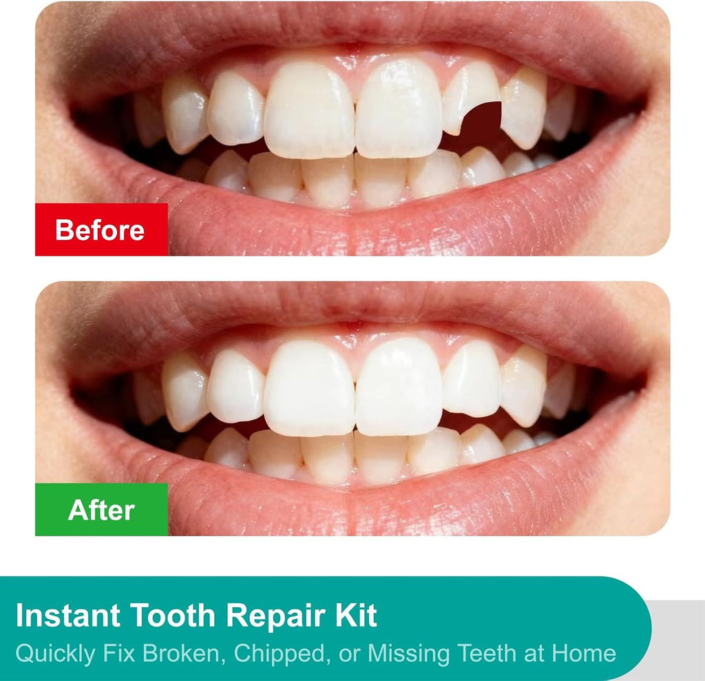 50Pcs Fake Tooth Covers for Bad Teeth Moldable Dental Repair Kit