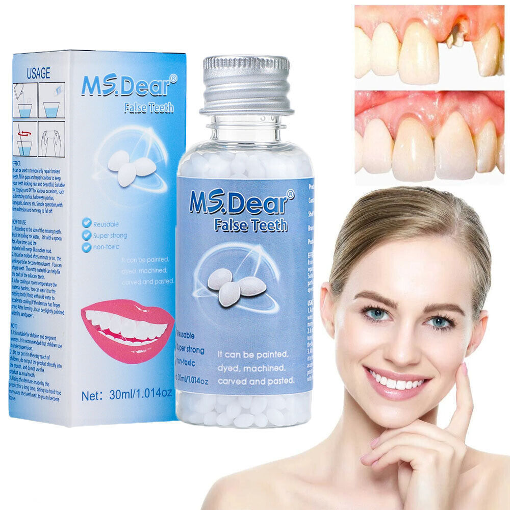 Temporary Dental Repair Kit for Broken Teeth & Cavities - Reusable Teeth Filler