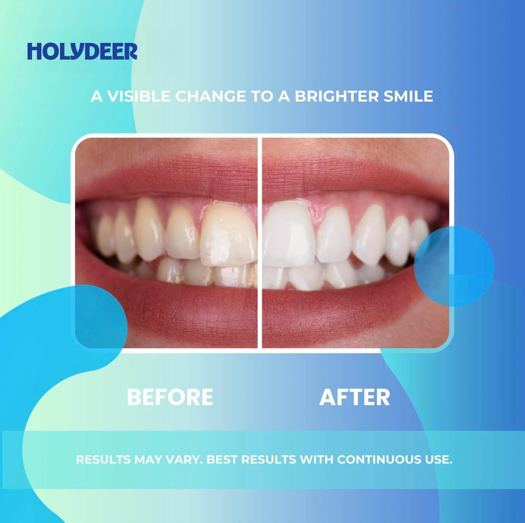 Nano-Hydroxyapatite Toothpaste Mint 7.5% Enamel Support Fluoride-Free Sensitive Whitening