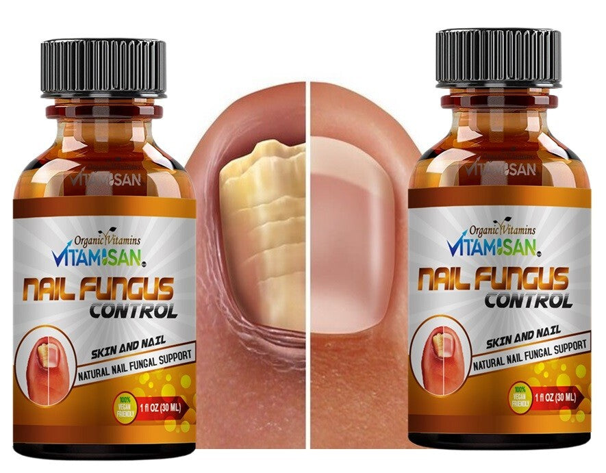 Maximum Strength Antifungal Toenail & Foot Support Spray for Athlete's Foot