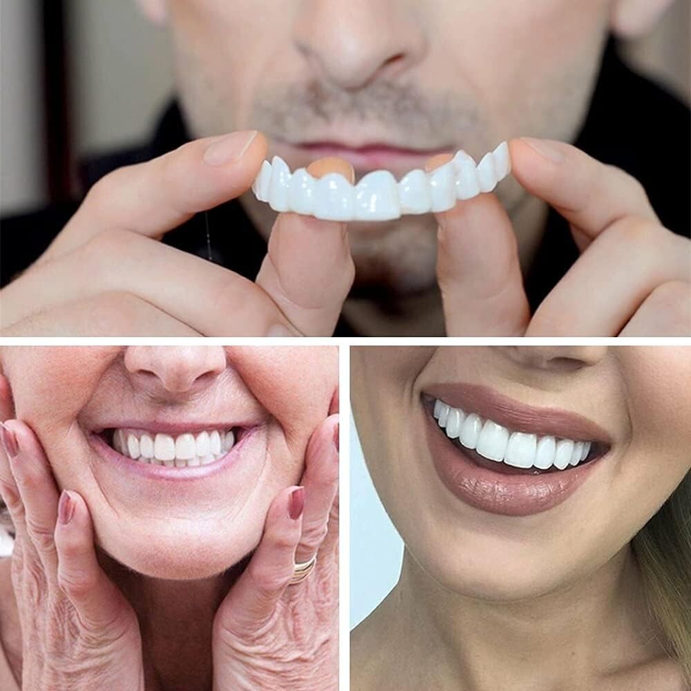 Instant Smile Dental Fake Teeth Set - Upper & Lower Temporary Dentures