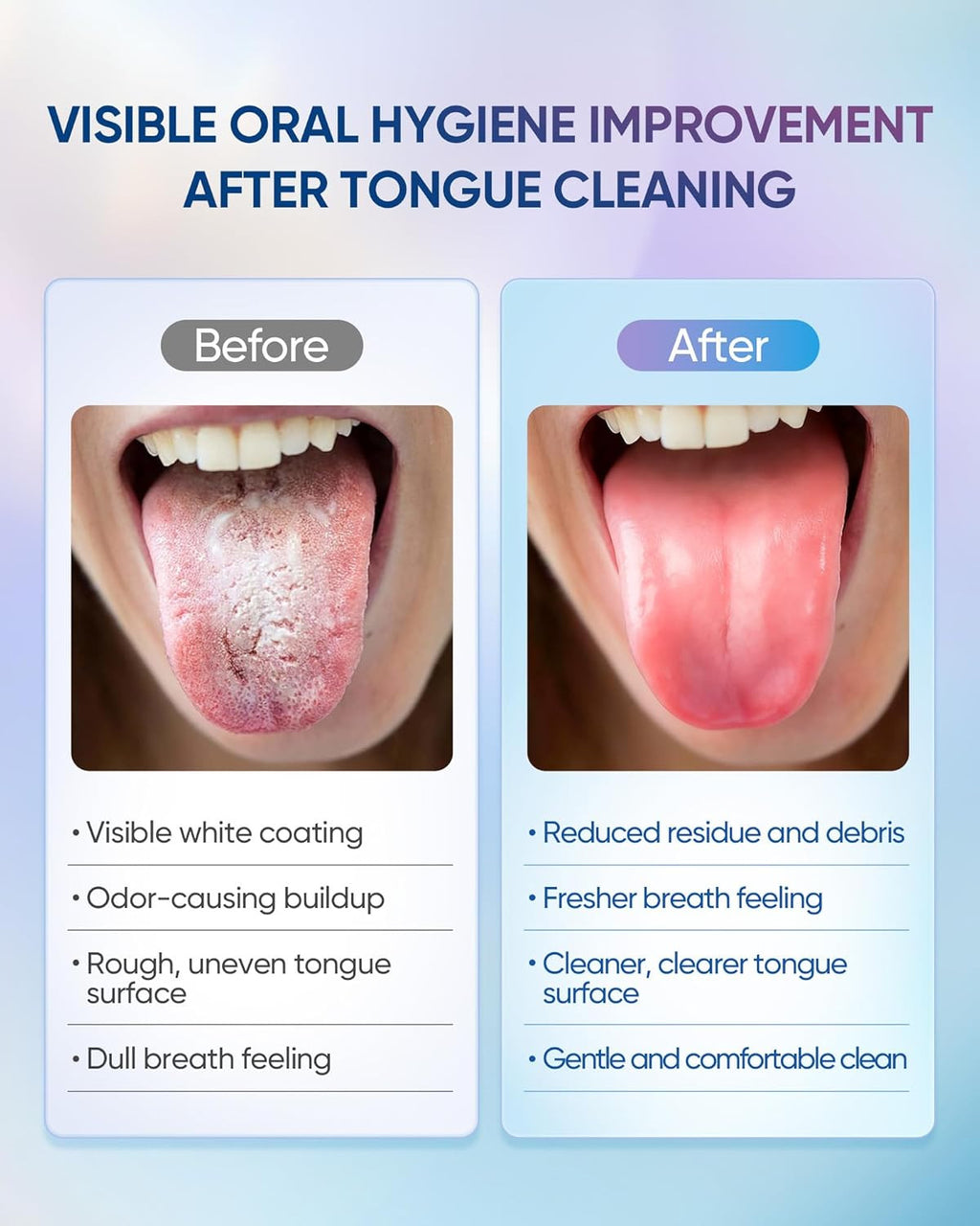 Tongue Cleaner Gel with Tongue Brush - Fresh Breath Oral Care Kit