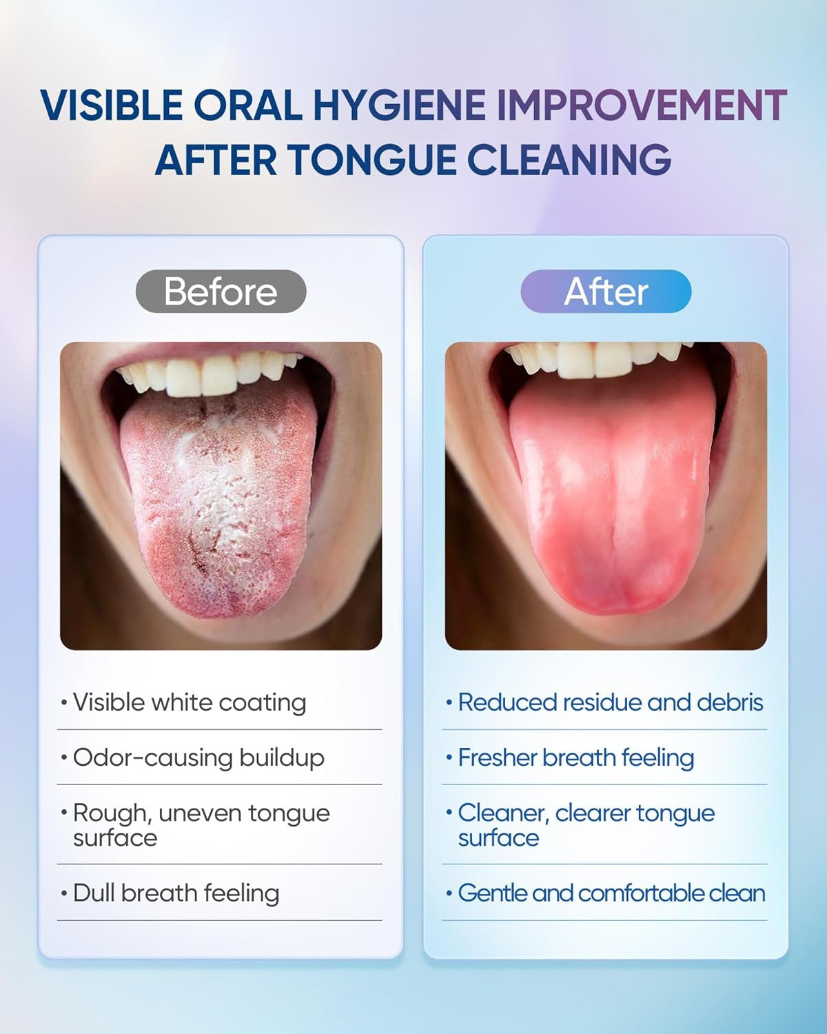 Tongue Cleaner Gel with Tongue Brush - Fresh Breath Oral Care Kit