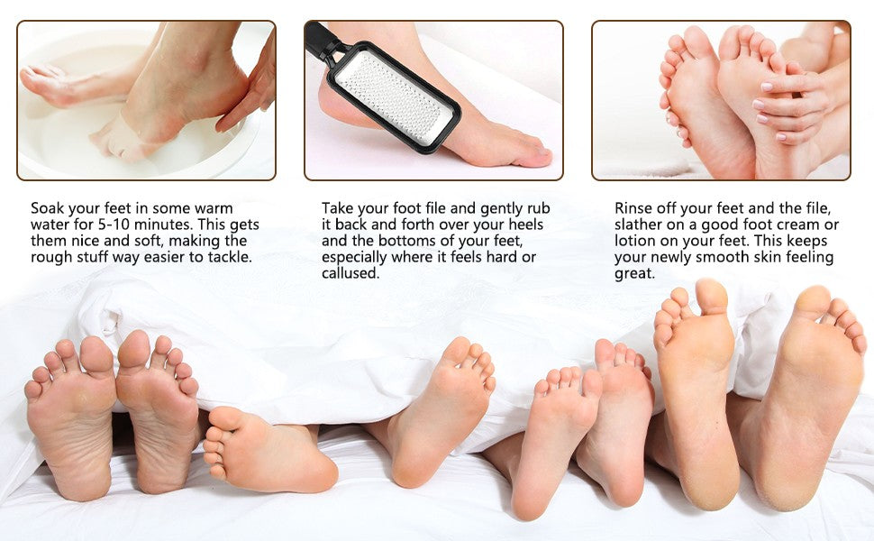 Foot Callus Remover File - Pedicure Rasp & Foot Scrubber Tool
