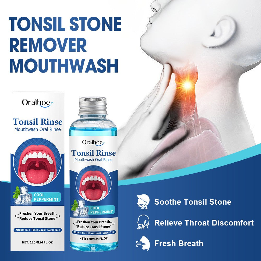 Natural Tonsil Stone Remover Mouthwash 2-Pack - Bad Breath & Oral Hygiene