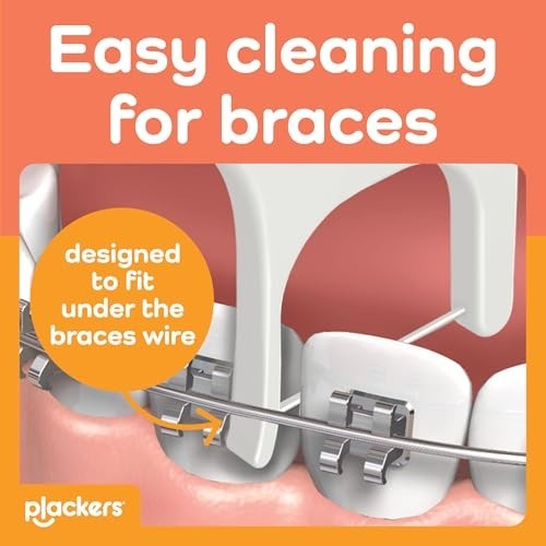 Dental Floss Picks for Braces - Pack of 36, 4-Count, Orthodontic Oral Care Tool