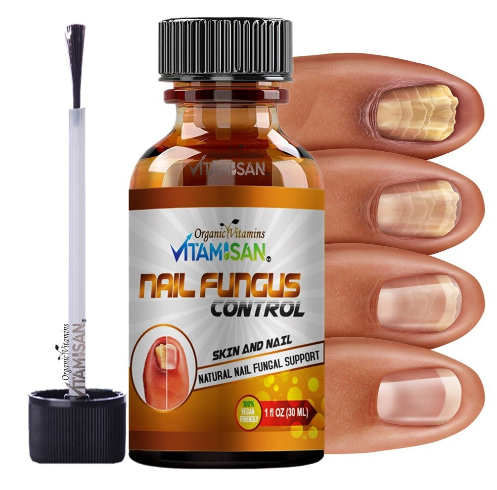 Maximum Strength Antifungal Toenail & Foot Support Spray for Athlete's Foot