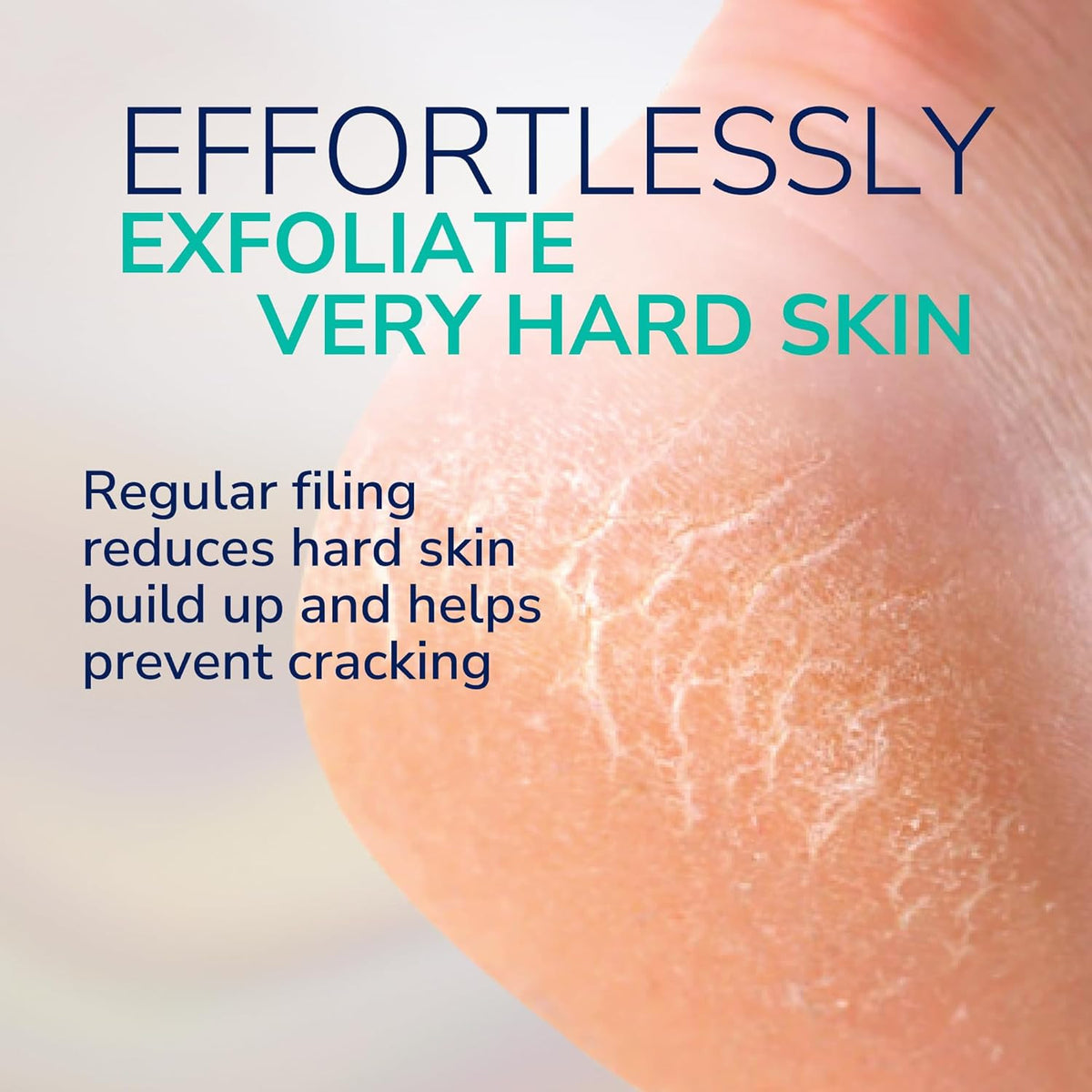 Electric Callus Remover Foot File for Hard Skin Removal - Rechargeable