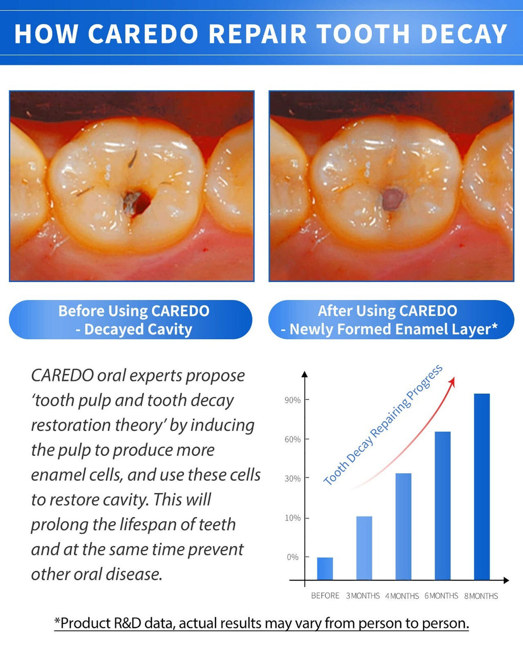 Hydroxyapatite Cavity Repair Toothpaste - Remineralizing Enamel & Sensitive Teeth