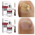 Ginger Antibacterial Nail Treatment Serum for Fungal Repair - 2PCS