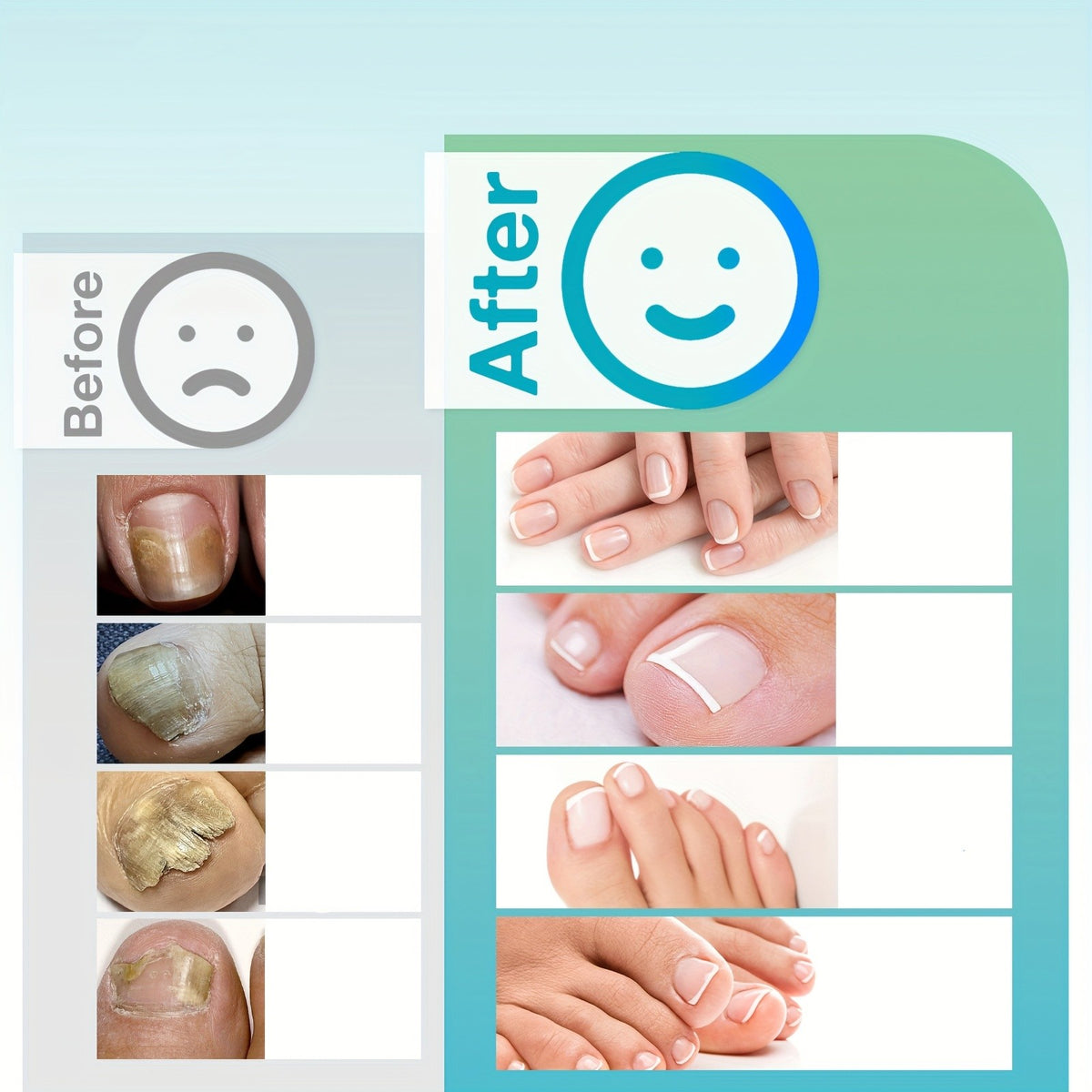 Rechargeable UV LED Nail Fungus Laser Device for Toenail Care & Fast Drying