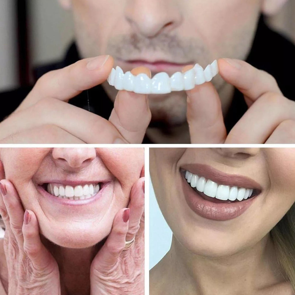 Snap-On Upper and Lower Dental Veneers Set for Adults - Reusable Teeth Covers