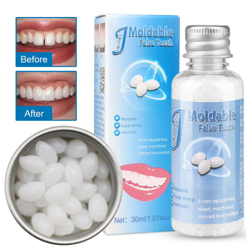 Teeth Thermal Fitting Beads Set for Temporary Tooth Repair & DIY Moldable Veneers