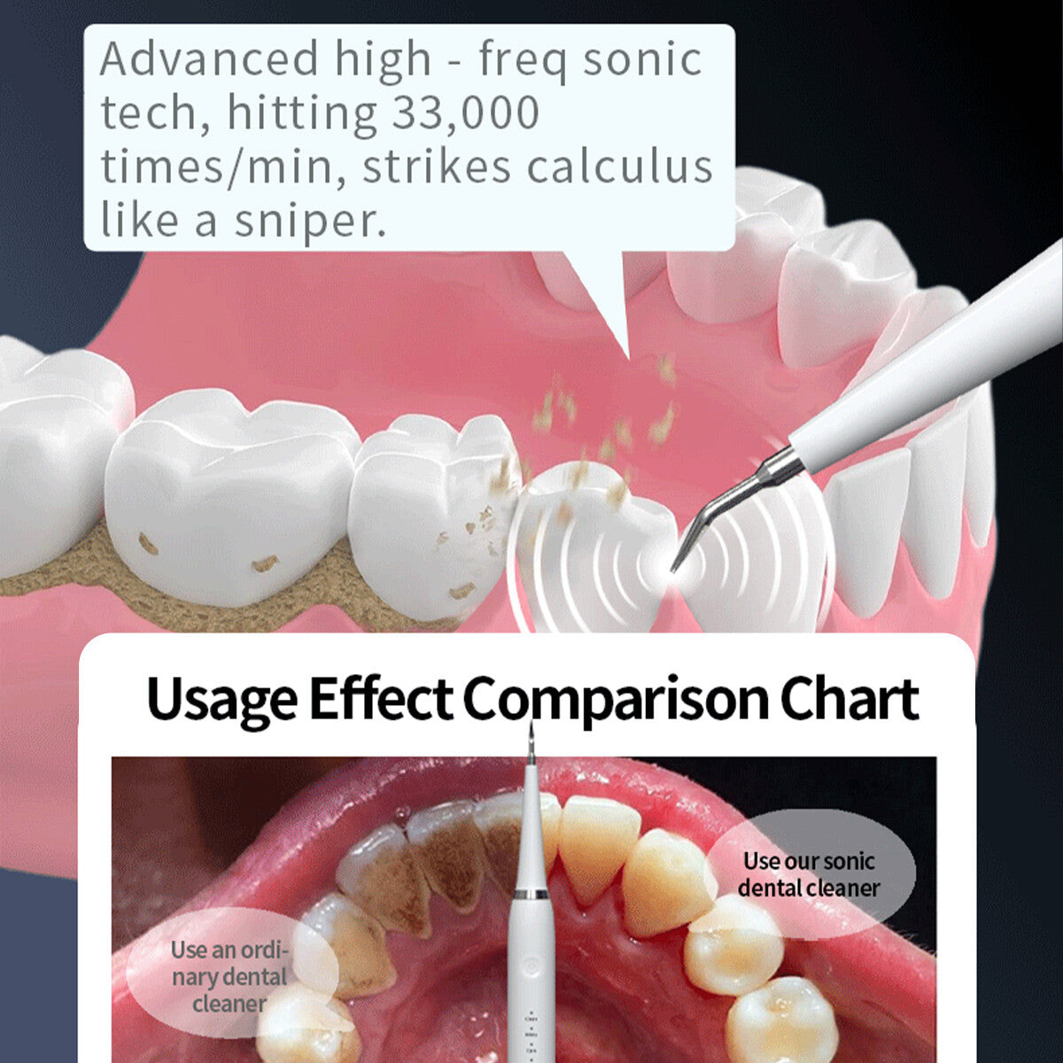 Ultrasonic Teeth Cleaner Kit for Dental Plaque & Stain Removal - Oral Care Device
