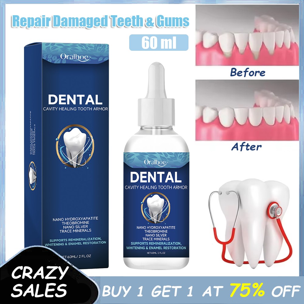 Dental Cavity Healing Serum - Tooth Armor Repair & Sensitivity Relief 60ml