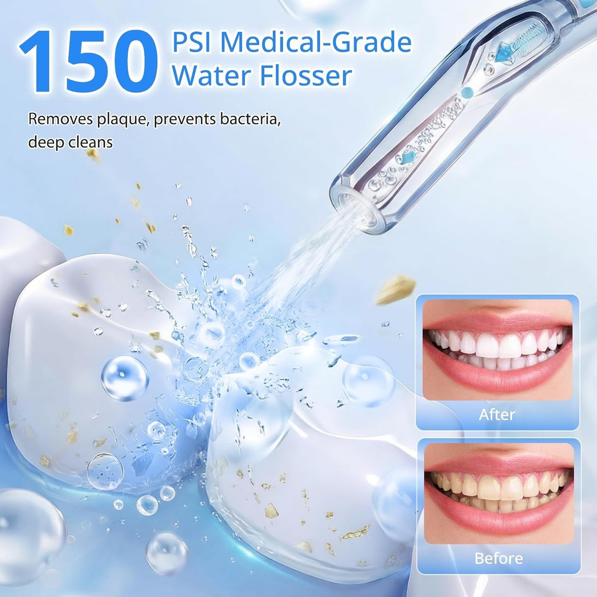 Portable Water Flosser for Teeth with 100 Power Levels, 0-150 PSI Adjustable Pressure, Cordless Dental Oral Care