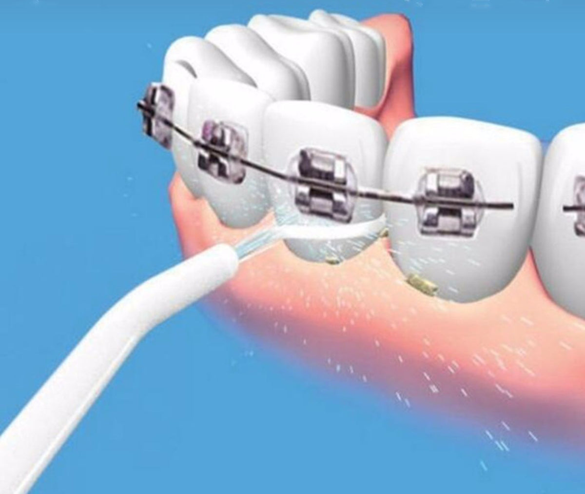 Portable Manual Water Flosser with Nasal Wash Tip for Oral and Nasal Care