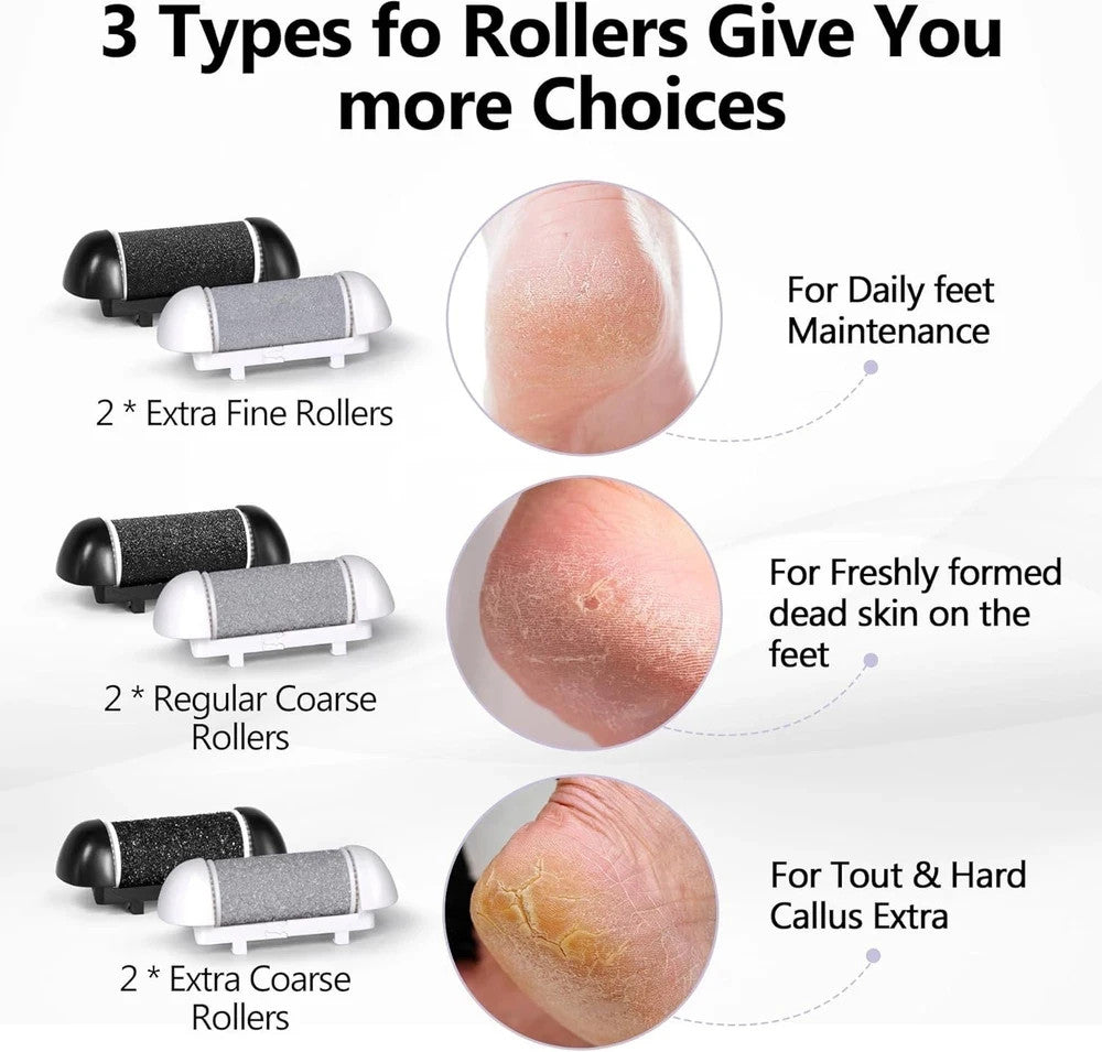 6 Pack Replacement Roller Heads for Electric Foot Callus Removers - Fine, Regular, Coarse