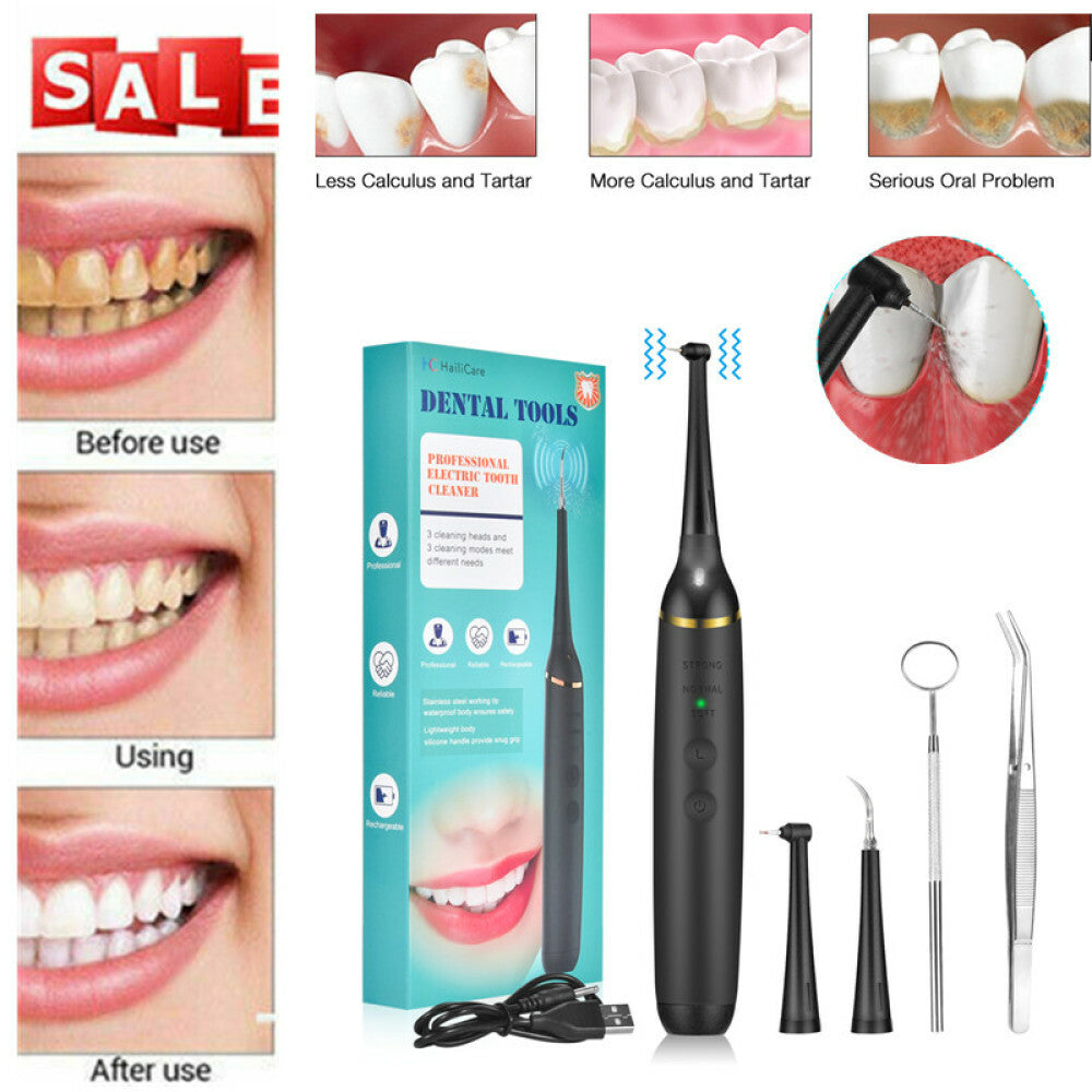 Electric Ultrasonic Tooth Cleaner Tartar & Plaque Remover Kit