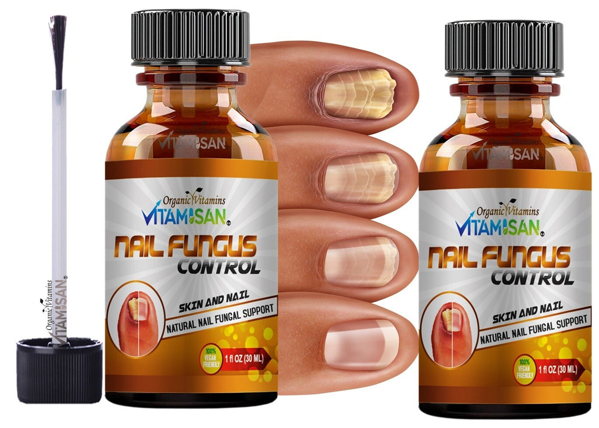 Maximum Strength Antifungal Toenail & Foot Support Spray for Athlete's Foot