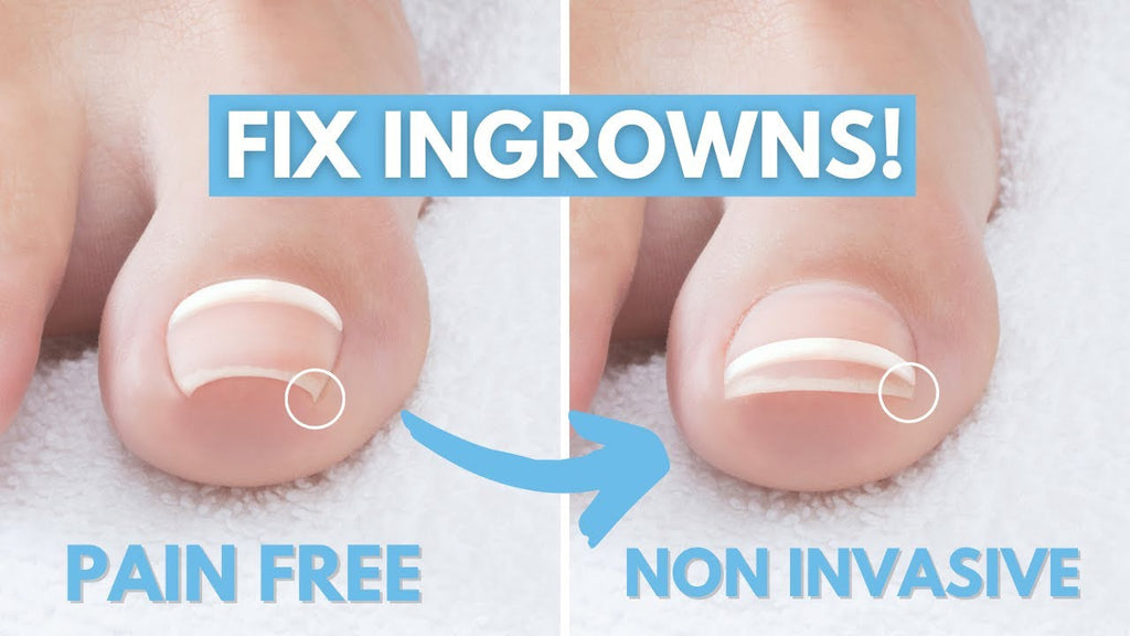 Fuzion UV/LED Nanoflex Toenail Concealer 12g - Natural Fungal Nail Treatment