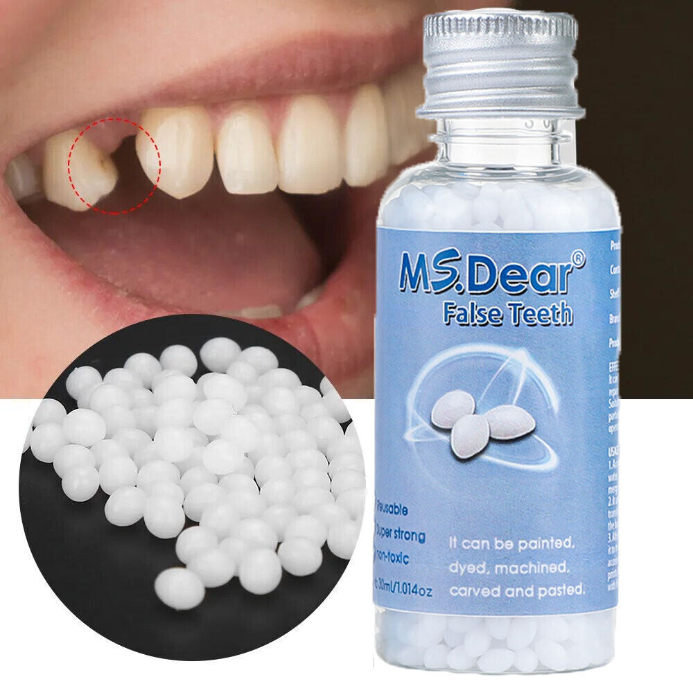 Teeth Repair Beads for Loose Tooth Fixing - Temporary Dental Moldable Resin