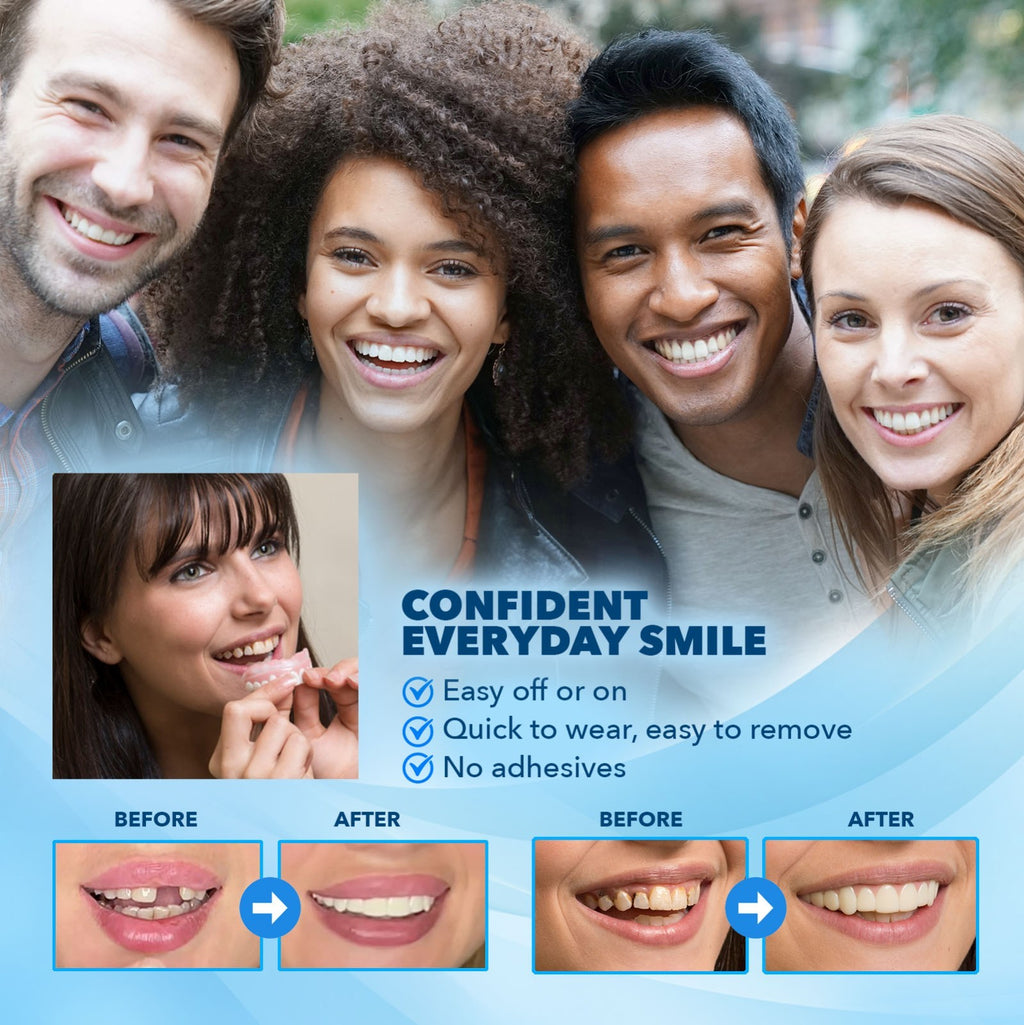 Cosmetic Teeth Cover Kit Large Natural White 2 Pack - DIY Smile Makeover