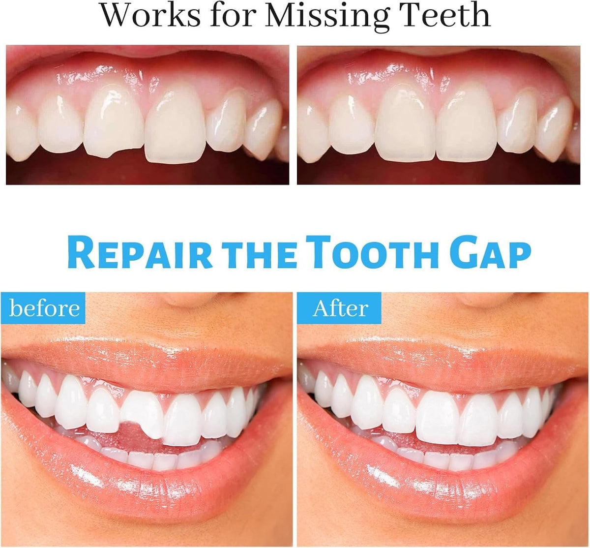 Dental Repair Kit Moldable Thermal Beads for Missing or Broken Teeth