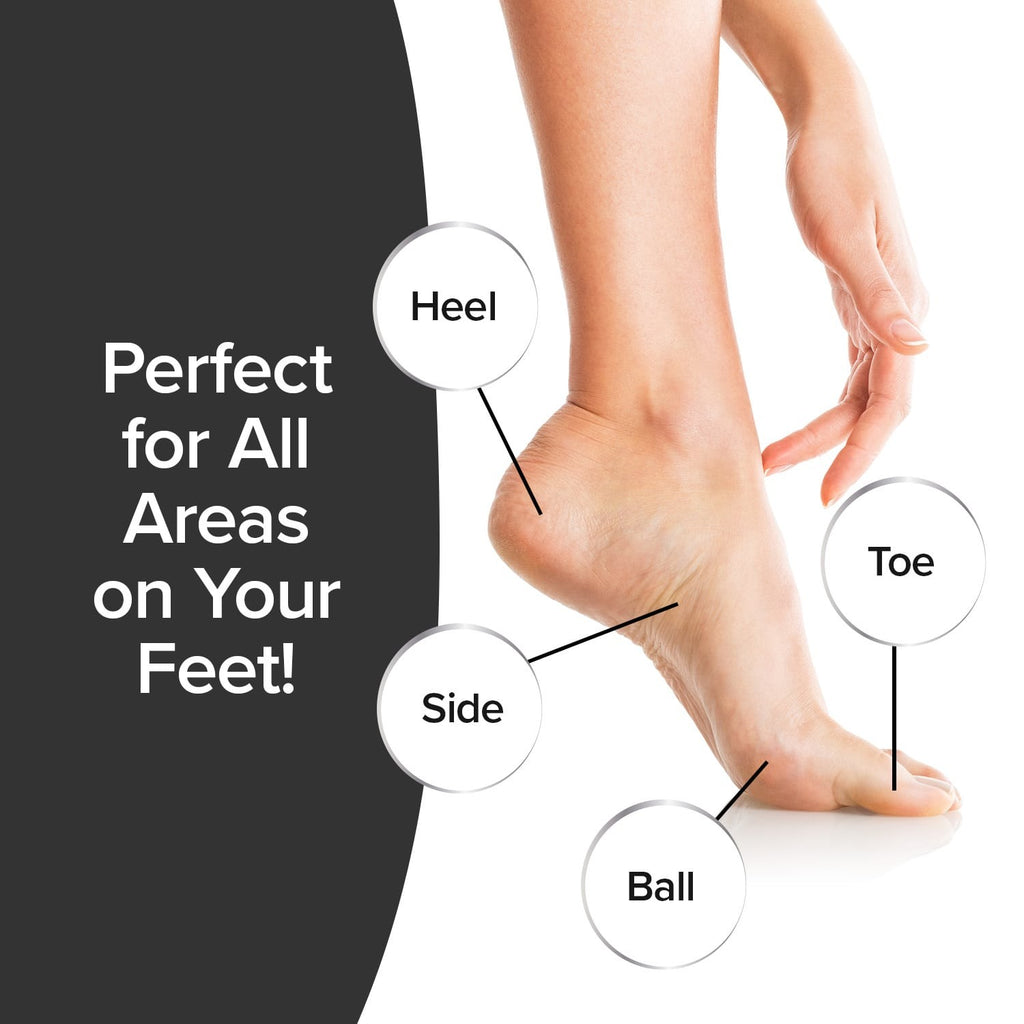 PedEgg Classic Callus Remover for Feet - Exfoliates Dry Skin & Calluses