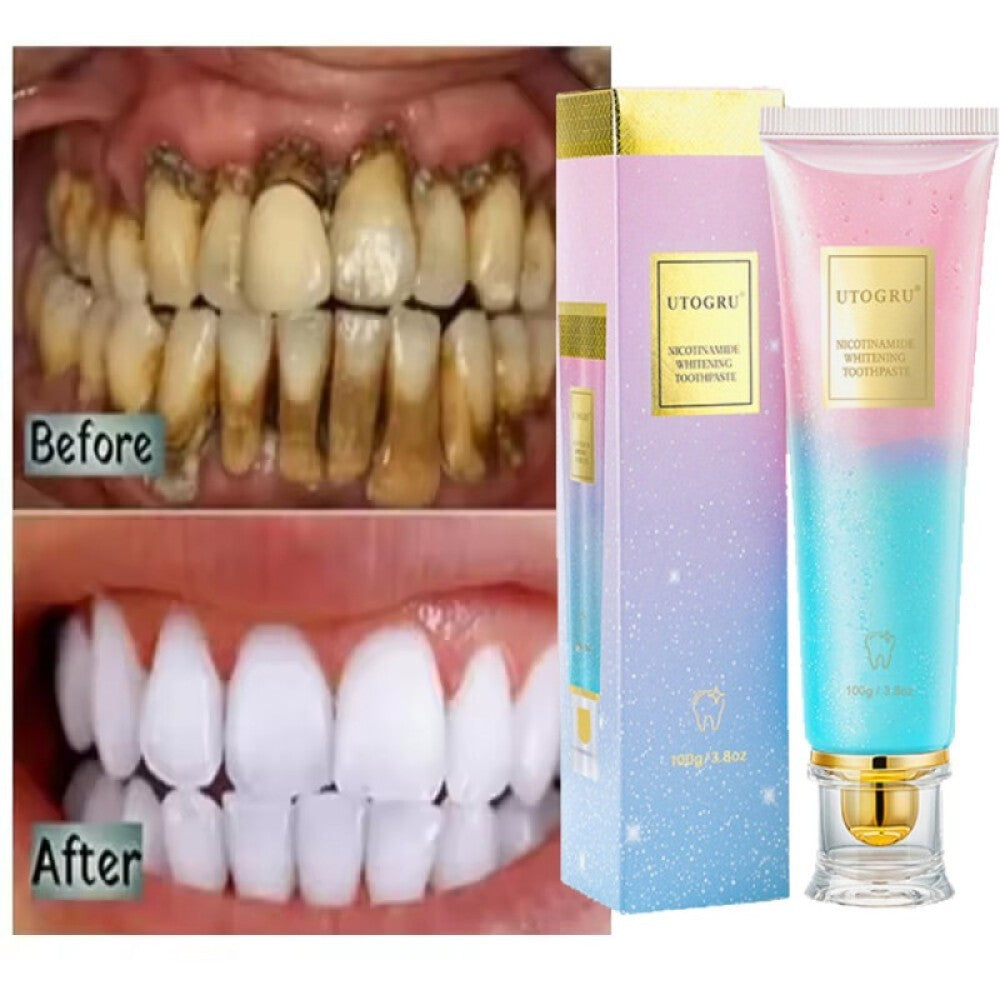 Niacinamide Whitening Toothpaste - Multiple Pack Sizes, Enamel Care & Fresh Breath