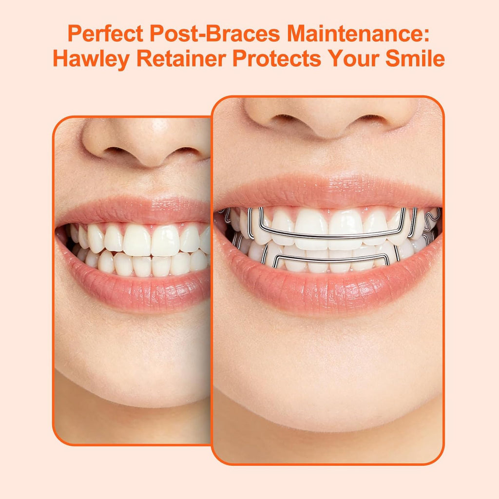 Custom Clear Retainer for Upper & Lower Teeth - Durable, Adjustable, Breathable