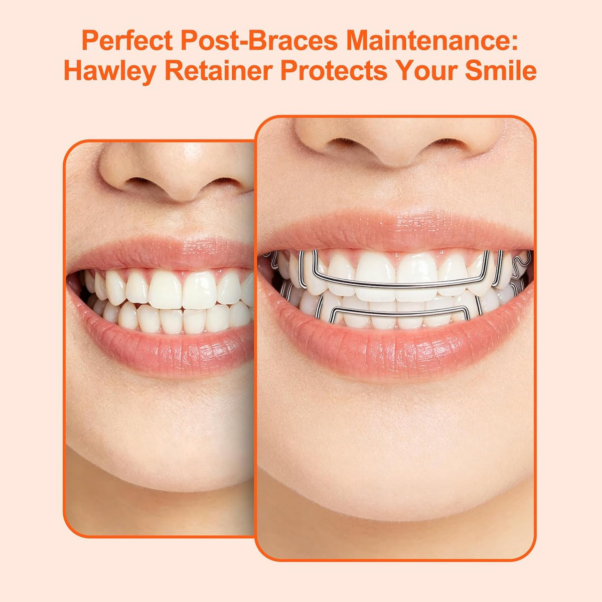 Custom Clear Retainer for Upper & Lower Teeth - Durable, Adjustable, Breathable