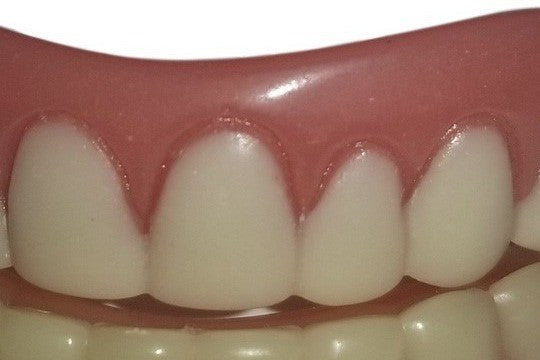 Small Instant Smile Teeth Set - Temporary Cosmetic Veneer for Top & Bottom