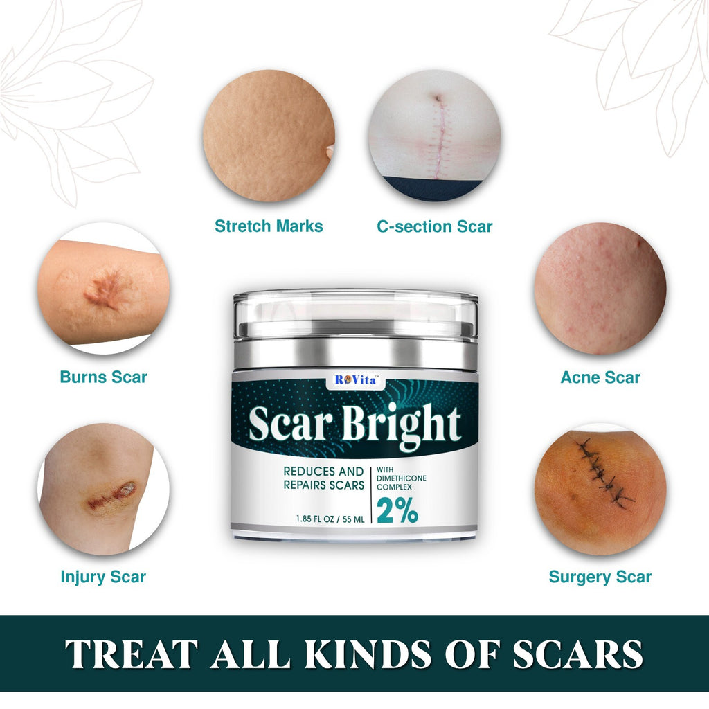 Scar Removal Cream for Fast Repair of Old & New Scars 55ML