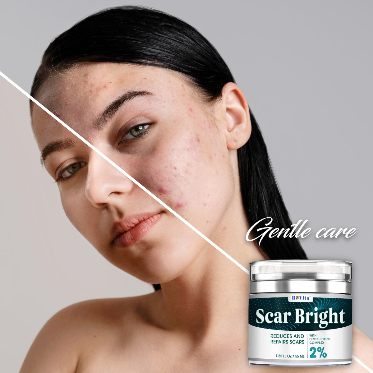 Scar Removal Cream for Fast Repair of Old & New Scars 55ML