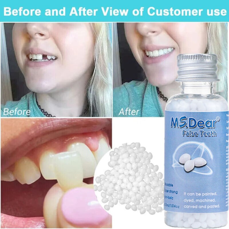 30ml Moldable Dental Repair Beads for Temporary Tooth Restoration