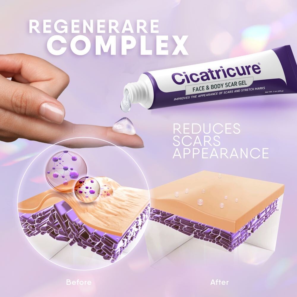 Scar Reducing Gel for Face & Body - 1 oz (30g) - Hydrating Scar & Stretch Mark Treatment