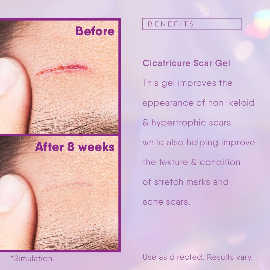 Scar Reducing Gel for Face & Body - 1 oz (30g) - Hydrating Scar & Stretch Mark Treatment