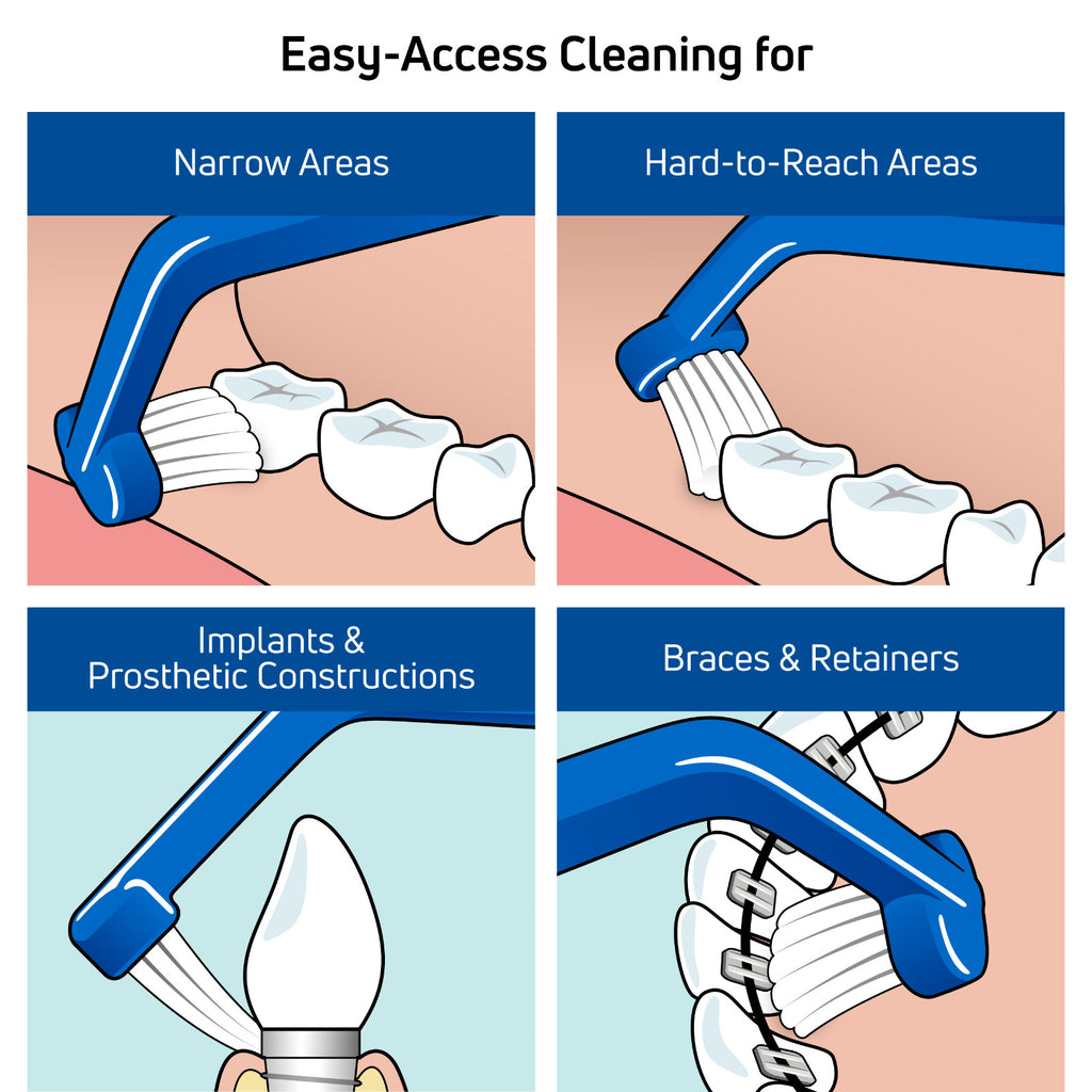 Universal Care Angled Toothbrush for Braces Retainers Implants - 1 Pack