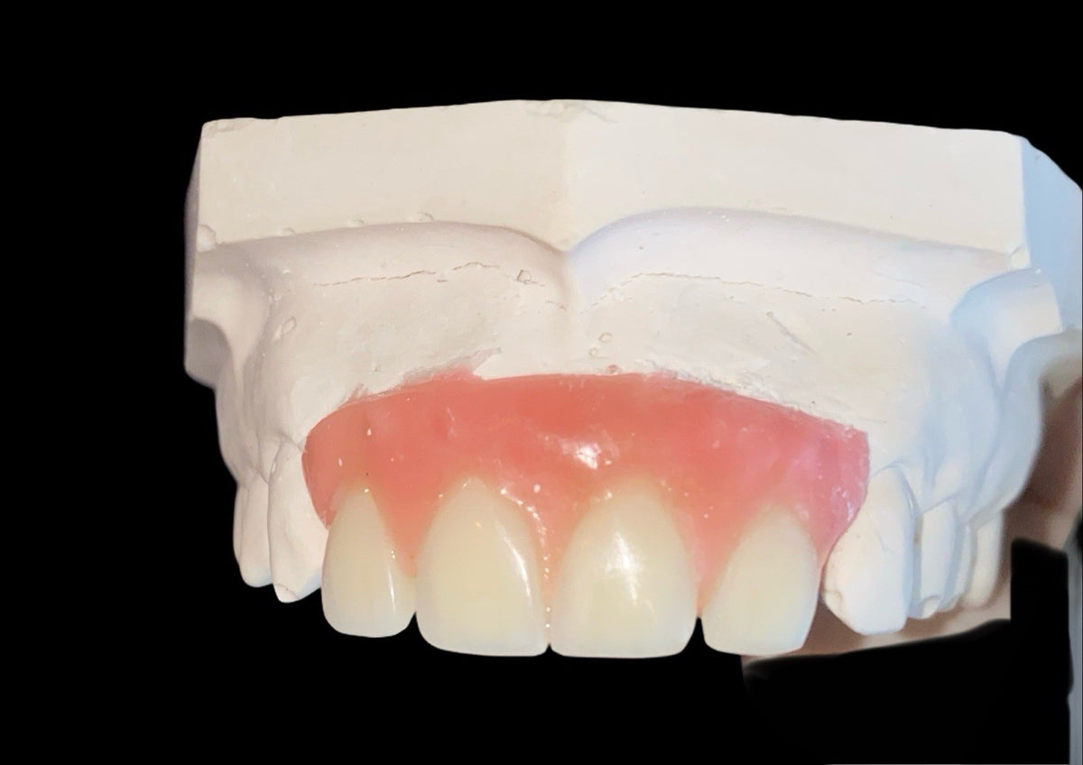 Missing Tooth Kit for Front Teeth Replacement Acrylic Teeth Set - A2 Shade