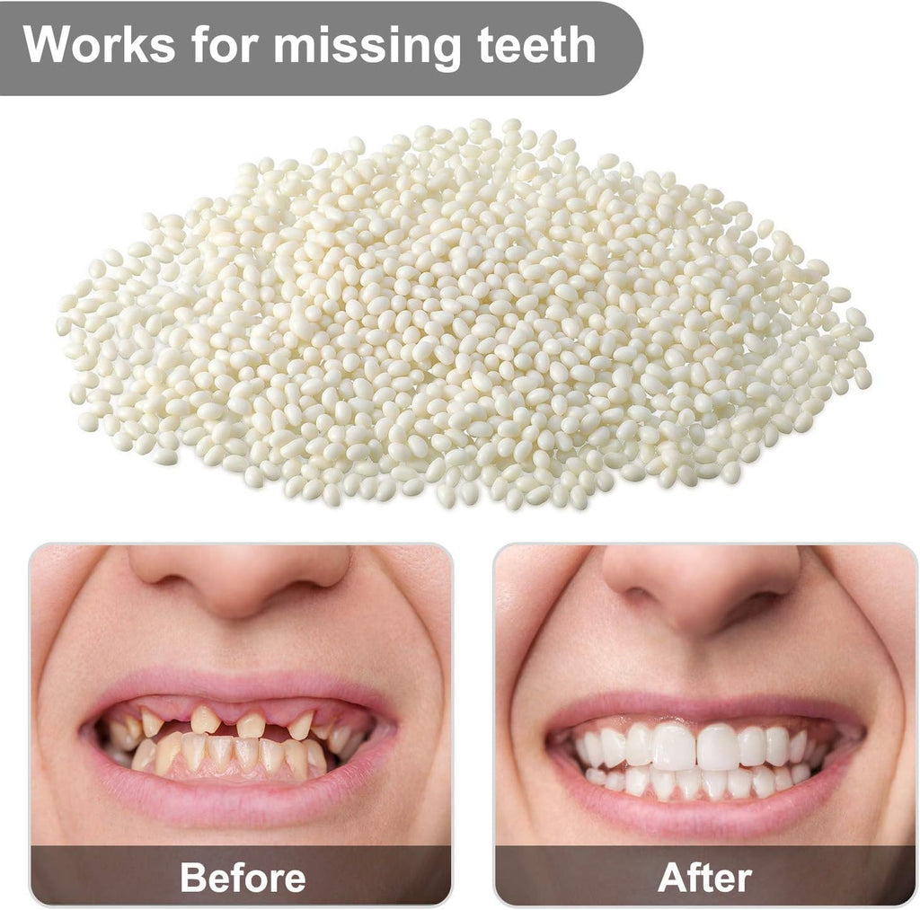 Tooth Repair Kit Moldable Beads for Dental Replacement & Fixing