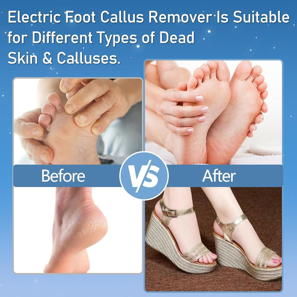 Electric Foot Callus Remover with 3 Rollers Waterproof Foot Care Kit