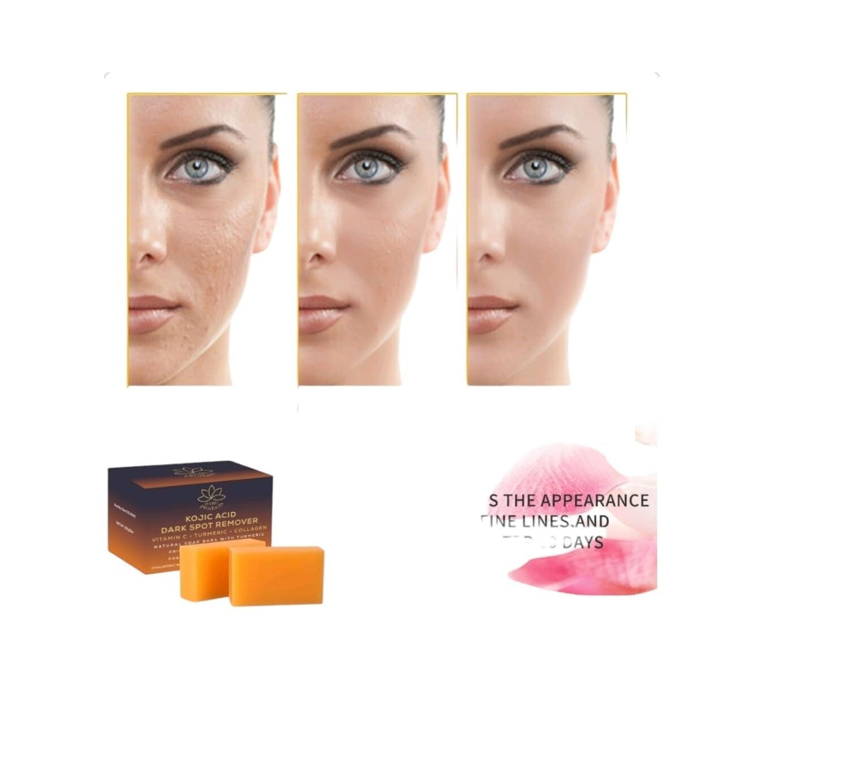 Kojic Acid Dark Spot Correcting Soap Bars with Vitamin C Retinol Collagen Turmeric 2 Pack