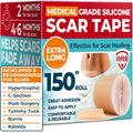 Medical Grade Silicone Scar Tape for Keloid & Surgical Scars - 1.6”x150”
