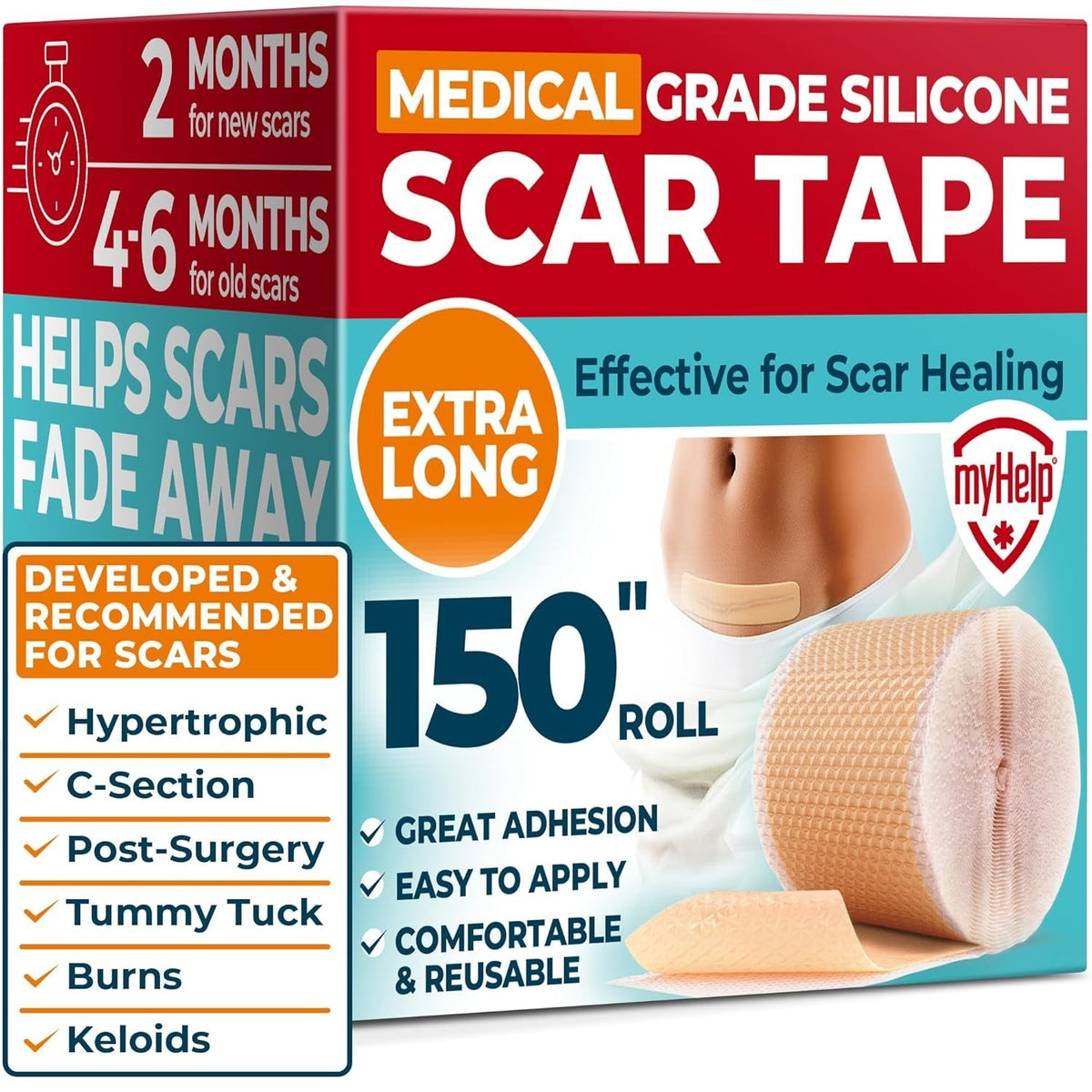 Medical Grade Silicone Scar Tape for Keloid & Surgical Scars - 1.6”x150”