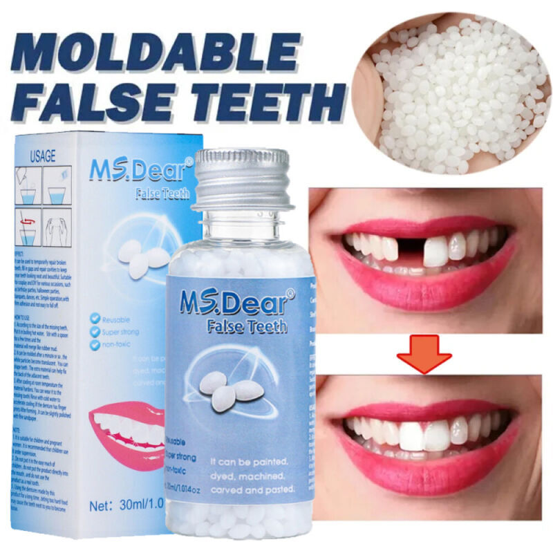 Reusable Moldable Tooth Repair Kit for Temporary Dental Fixes
