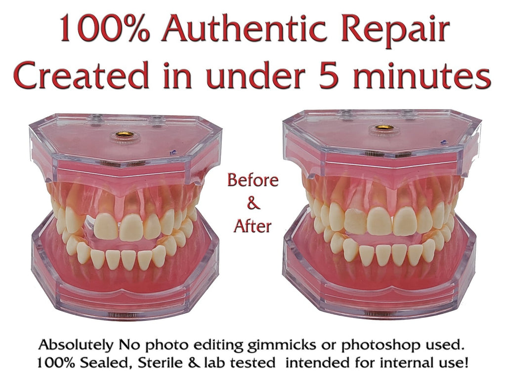 Dental Repair Kit for Missing or Broken Teeth - Color Match & Easy Fix